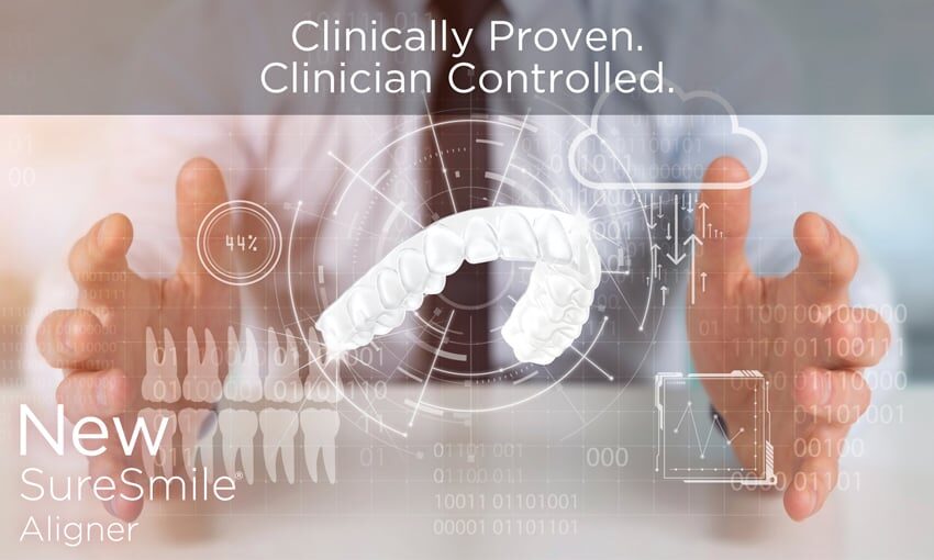 SureSmile aligner product at Beck Dental Center